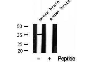 Western blot analysis of extracts of mouse brain tissue, using LDHB antibody. (LDHB 抗体  (N-Term))