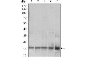 Western blot analysis using MRPL42 mouse mAb against HL7702 (1), SMMC-7721 (2), HEK293 (3) , HeLa (4) and Raji (5) cell lysate. (MRPL42 抗体  (AA 10-142))