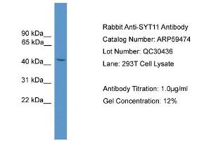 WB Suggested Anti-SYT11  Antibody Titration: 0. (SYT11 抗体  (N-Term))