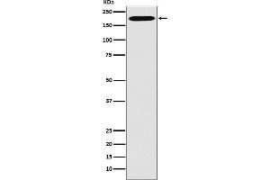 Western Blotting (WB) image for anti-Clathrin Heavy Chain (CLTC) antibody (ABIN7606772)