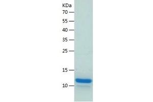 SDS-PAGE (SDS) image for Ubiquitin-Like 5 (UBL5) (AA 1-73) protein (His tag) (ABIN7125639)