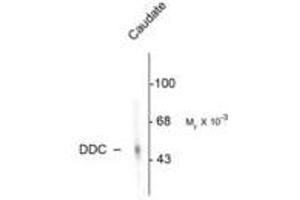 Image no. 1 for anti-Dopa Decarboxylase (Aromatic L-Amino Acid Decarboxylase) (DDC) antibody (ABIN220954) (DDC 抗体)