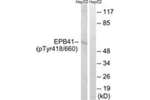 Western blot analysis of extracts from HepG2 cells treated with PMA 125ng/ml 30', using EPB41 (Phospho-Tyr660/418) Antibody. (EPB41 抗体  (pTyr660))