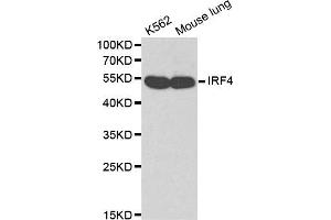 Western blot analysis of K562 cell lines and mouse lung using IRF4 antibody.