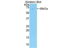 Western Blotting (WB) image for anti-Collagen, Type XVIII (COL18) (AA 1072-1271) antibody (ABIN1858450) (COL18 抗体  (AA 1072-1271))