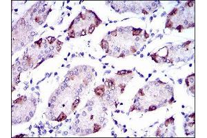 Immunohistochemistry (IHC) image for anti-Solute Carrier Family 27 (Fatty Acid Transporter), Member 5 (SLC27A5) (AA 508-570) antibody (ABIN1845742)
