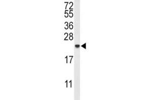 Western blot analysis of IL-10 antibody and MDA-MB435 lysate. (IL-10 抗体  (AA 27-53))