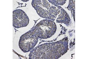 Immunohistochemistry (IHC) image for anti-Glutathione S-Transferase mu 3 (Brain) (GSTM3) (AA 93-206) antibody (ABIN5693252)
