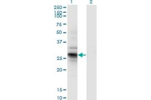 Western Blot analysis of IDI2 expression in transfected 293T cell line by IDI2 monoclonal antibody (M01), clone 1C11. (IPP Isomerase 2 抗体  (AA 1-227))