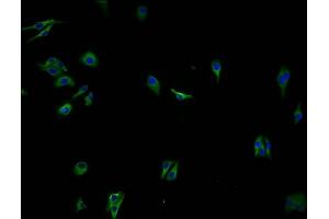 Immunofluorescence staining of HepG2 cells with ABIN7139976 at 1:100, counter-stained with DAPI. (OR2A7 抗体  (AA 258-273))