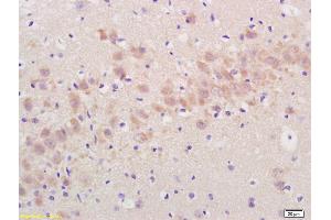 Formalin-fixed and paraffin embedded rat brain labeled with Rabbit Anti Annexin A13 Polyclonal Antibody, Unconjugated (ABIN724250) at 1:200 followed by conjugation to the secondary antibody and DAB staining (ARTN 抗体  (AA 101-170))