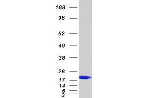 Western Blotting (WB) image for phosphodiesterase 6D, CGMP-Specific, Rod, delta (PDE6D) protein (Myc-DYKDDDDK Tag) (ABIN2728519)