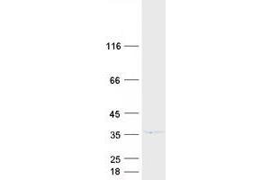 Western Blotting (WB) image for Cell Cycle Checkpoint Protein RAD1 (RAD1) (Transcript Variant 1) protein (Myc-DYKDDDDK Tag) (ABIN2730397)