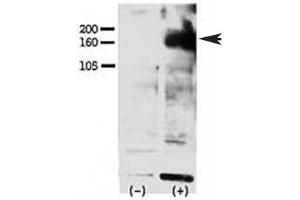 Western Blotting (WB) image for anti-V-Erb-A erythroblastic Leukemia Viral Oncogene Homolog 4 (Avian) (ERBB4) (pTyr1162) antibody (ABIN3029487)