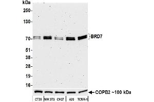 Western Blotting (WB) image for anti-Bromodomain Containing 7 (BRD7) (AA 150-200) antibody (ABIN7449350)