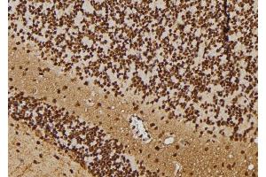 Immunohistochemistry (IHC) image for anti-Recombination Signal Binding Protein For Immunoglobulin kappa J Region (RBPJ) (C-Term) antibody (ABIN6264674)