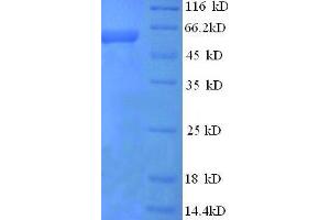 SDS-PAGE (SDS) image for Secreted phosphoprotein 1 (SPP1) (AA 17-300), (partial) protein (His tag) (ABIN1047487)