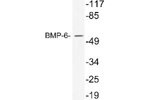 Western blot (WB) analysis of BMP-6 antibody in extracts from 293 cells treated with TNF. (BMP6 抗体)