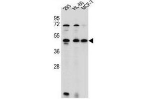 ANKRD40 Antibody (C-term) western blot analysis in 293,HL-60,MCF-7 cell line lysates (35µg/lane). (ANKRD40 抗体  (C-Term))