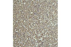 IHC analysis of CD69 using anti-CD69 antibody (ABIN7599623). (CD69 抗体  (AA 101-148))