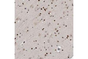 Immunohistochemical staining of human cerebral cortex with ZEB1 polyclonal antibody  shows strong nuclear positivity in glial cells at 1:500-1:1000 dilution. (ZEB1 抗体)
