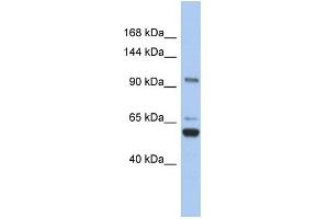 WB Suggested Anti-TRPM8 Antibody Titration:  0.
