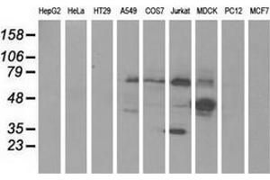 Western blot analysis of extracts (35 µg) from 9 different cell lines by using anti-KLHL2 monoclonal antibody. (KLHL2 抗体  (AA 1-100, AA 494-593))