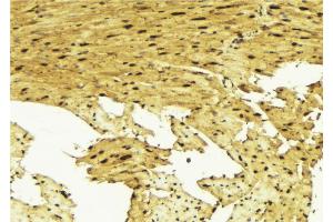 Immunohistochemistry (IHC) image for anti-SMAD, Mothers Against DPP Homolog 1 (SMAD1) (pSer187) antibody (ABIN6256175)