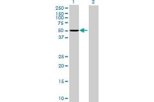 Western Blot analysis of ASNS expression in transfected 293T cell line by ASNS MaxPab polyclonal antibody. (Asparagine Synthetase 抗体  (AA 1-561))