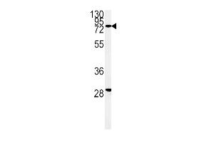 Western blot analysis of ZFYVE16 Antibody (N-term) (ABIN651313 and ABIN2840182) in K562 cell line lysates (35 μg/lane). (ZFYVE16 抗体  (N-Term))