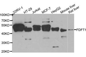 Western Blotting (WB) image for anti-Farnesyl-Diphosphate Farnesyltransferase 1 (FDFT1) antibody (ABIN1882356) (FDFT1 抗体)