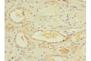 Immunohistochemistry of paraffin-embedded human kidney tissue using ABIN7174375 at dilution of 1:100 (UBE4A 抗体  (AA 797-1066))