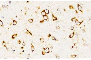 Immunohistochemistry of paraffin-embedded Rat brain using LAMP3 Polyclonal Antibody at dilution of 1:200 (40x lens). (LAMP3 抗体)