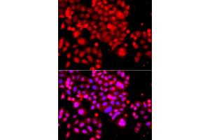 Immunofluorescence analysis of  cells using  antibody (ABIN6133295, ABIN6137172, ABIN6137173 and ABIN6223966). (ASCC3 抗体  (AA 1-111))