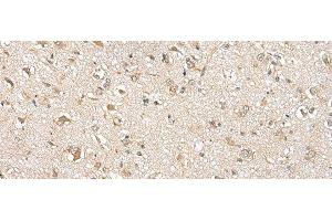 Immunohistochemistry (Paraffin-embedded Sections) (IHC (p)) image for anti-Nudix (Nucleoside Diphosphate Linked Moiety X)-Type Motif 10 (NUDT10) antibody (ABIN7245821)