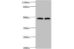 Western blot All lanes: Protein FAM114A2 antibody at 2 μg/mL Lane 1: Mouse kidney tissue Lane 2: U251 whole cell lysate Secondary Goat polyclonal to rabbit IgG at 1/10000 dilution Predicted band size: 55 kDa Observed band size: 55 kDa (FAM114A2 抗体  (AA 1-505))