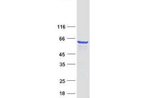 Western Blotting (WB) image for Membrane Protein, Palmitoylated 2 (MAGUK P55 Subfamily Member 2) (MPP2) protein (Myc-DYKDDDDK Tag) (ABIN2726288)