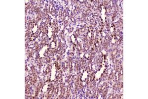 IHC testing of FFPE rat kidney tissue with Leptin antibody at 2ug/ml.
