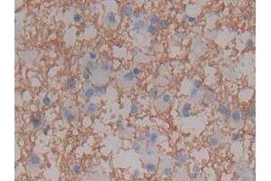Immunohistochemistry (IHC) image for anti-Myelin Basic Protein (MBP) (AA 135-190) antibody (ABIN7442024)