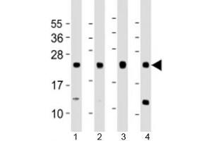 Western blot testing of human 1) A431, 2) HeLa, 3) HepG2 and 4) MCF-7 cell lysate with LITAF antibody at 1:1000. (LITAF 抗体  (AA 31-60))