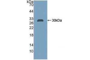 Detection of Recombinant CA2, Rat using Polyclonal Antibody to Carbonic Anhydrase II (CA2) (CA2 抗体  (AA 1-260))