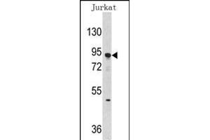 Western blot analysis of anti-DNMT3A Antibody (Center ) (ABIN387882 and ABIN2844093) in Jurkat cell line lysates (35 μg/lane). (DNMT3A 抗体  (AA 457-486))