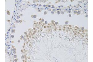 Immunohistochemistry of paraffin-embedded rat testis using PHC1 antibody (ABIN5973455) at dilution of 1/100 (40x lens). (PHC1 抗体)