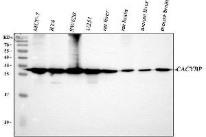 Western blot analysis of CACYBP using anti-CACYBP antibody (ABIN4886495).