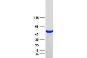 Western Blotting (WB) image for Diphthamide Biosynthesis 7 (DPH7) protein (Myc-DYKDDDDK Tag) (ABIN2735541)