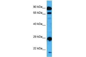 Host:  Mouse  Target Name:  MED6  Sample Tissue:  Mouse Testis  Antibody Dilution:  1ug/ml (MED6 抗体  (Middle Region))
