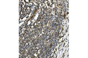 IHC analysis of TRIM25 using anti-TRIM25 antibody (ABIN7599495). (TRIM25 抗体  (AA 1-610))