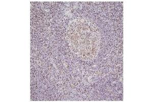 Immunohistochemistry This image shows paraffin-embedded human palatine tonsil tissue sample stained with anti-NPM antibody(5E3) at 1:100 dilution. (NPM1 抗体)