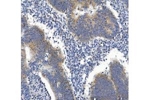 IHC analysis of GDF8/Myostatin/MSTN using anti-GDF8/Myostatin/MSTN antibody (ABIN7602824).