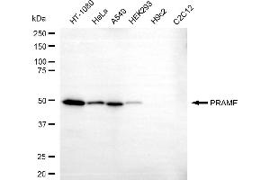 Western blotting analysis using PRAME antibody (ABIN7799893).
